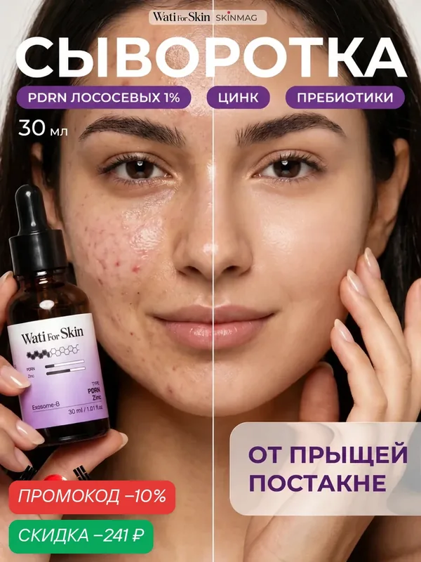 Сыворотка для проблемной кожи Wati For Skin, цинк и пробиотики, 30мл — Wati for Skin, скидка по промокоду Яндекс Маркет