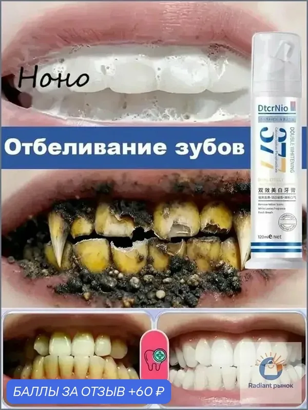 Отбеливающая зубная паста 120 г / упаковка. Удаляет зубной камень, осветляет эмаль, освежает дыхание, предотвращает кариес, снижает чувствительность зубов, уход за полостью рта. — 60 баллов за отзыв Яндекс Маркет